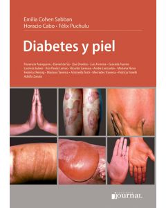  Diabetes y Piel