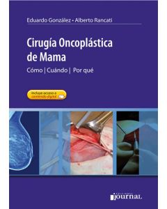 Cirugía Oncoplástica de Mama. Cómo, Cuándo, Por qué