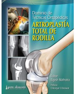 Dominio de Técnicas Ortopédicas: Artroplastía Total de Rodilla 