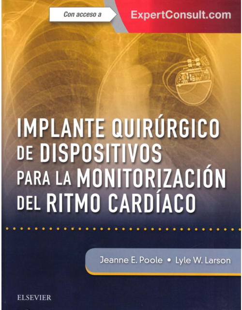 Implante Quirúgico De Dispositivos Para La Monitorización Del Ritmo Cardiáco + Expertconsult