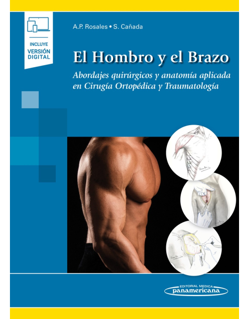 El Hombro Y El Brazo Abordajes Quirúrgicos Y Anatomía Aplicada En Cirugía Ortopédica Y Traumatología Incluye Ebook