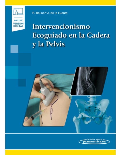 Intervencionismo Ecoguiado En La Cadera Y La Pelvis Incluye Ebook
