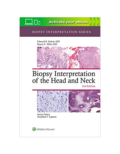 Biopsy Interpretation Of The Head And Neck 3Ed