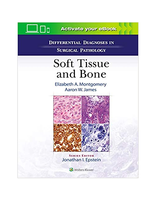 Differential Diagnoses In Surgical Pathology Soft Tissue And Bone