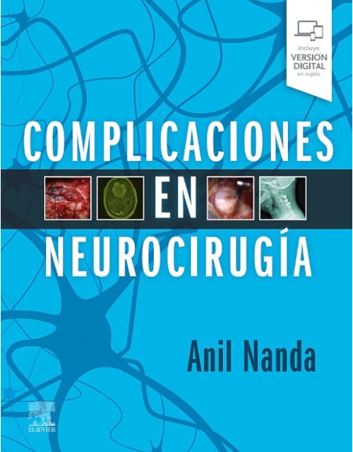Complicaciones En Neurocirugía