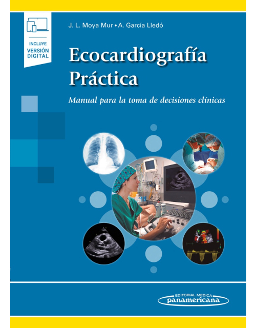Ecocardiografía Práctica Manual Para La Toma De Decisiones Clínicas Incluye Ebook