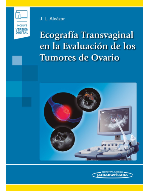 Ecografía Transvaginal En La Evaluación De Los Tumores De Ovario Incluye Ebook