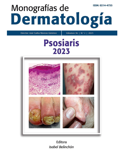 Monografías de Dermatología. Psoriasis 2023