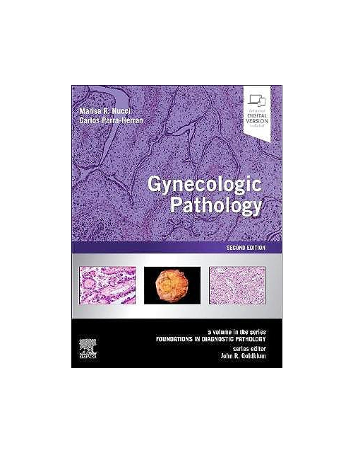 Gynecologic Pathology 2Ed (Enhanced Digital Version Included)