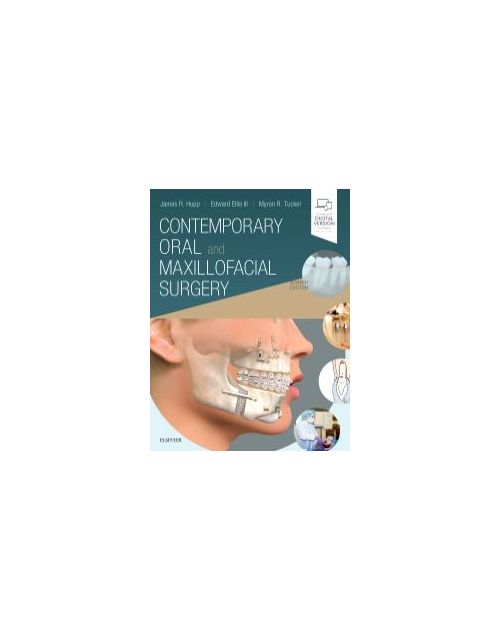 Contemporary Oral And Maxillofacial Surgery