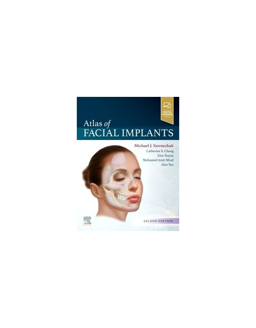 Atlas Of Facial Implants, 2Nd Edition