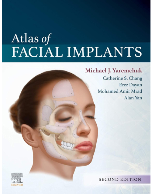 Atlas Of Facial Implants