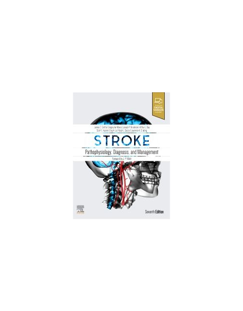 Stroke, 7Th Edition