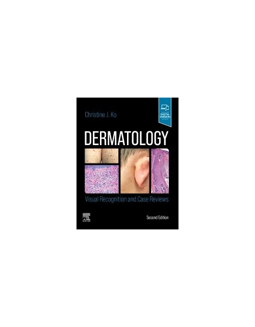 Dermatology: Visual Recognition And Case Reviews, 2Nd Edition