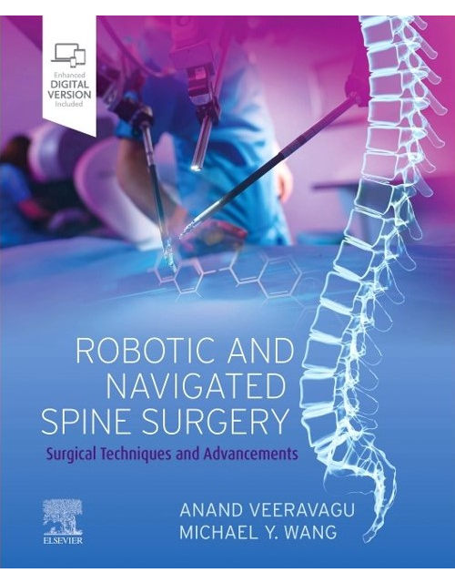 Robotic And Navigated Spine Surgery