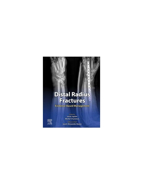 Distal Radius Fractures, 1St Edition