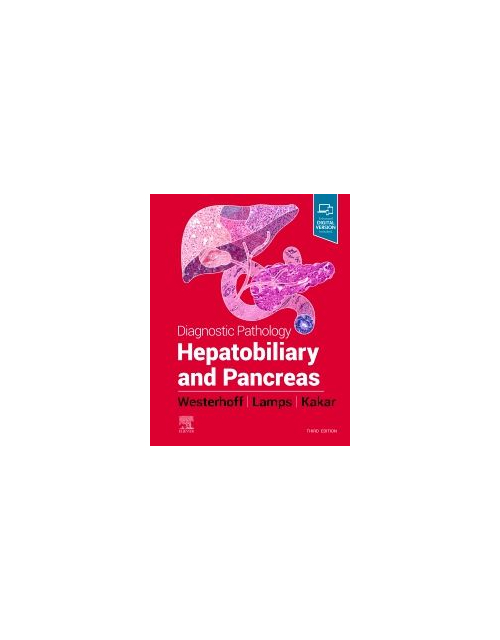 Diagnostic Pathology : Hepatobiliary And Pancreas, 3Rd Edition