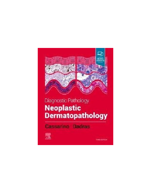 Diagnostic Pathology: Neoplastic Dermatopathology, 3Rd Edition