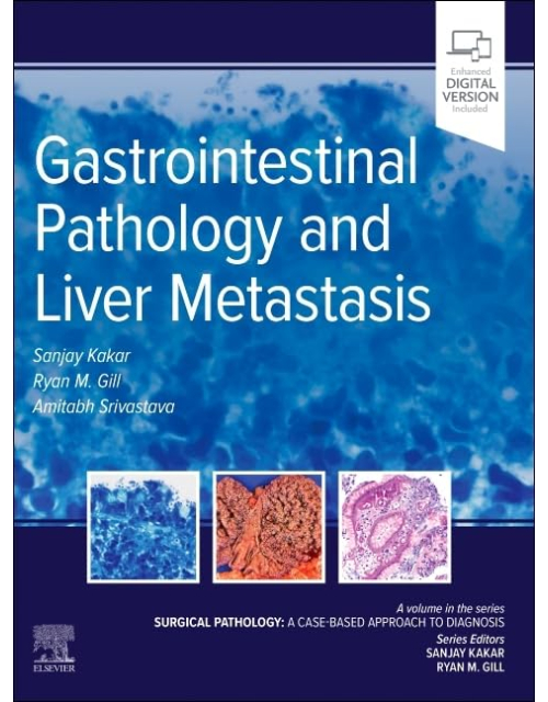 Gastrointestinal Pathology and Liver Metastasis