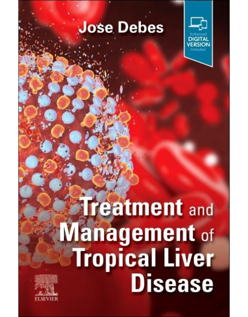 Treatment and Management of Tropical Liver Disease