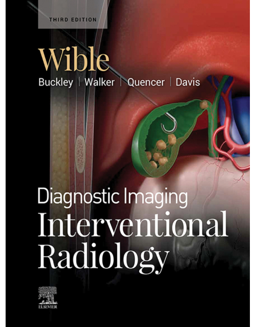 Diagnostic Imaging: Interventional Radiology