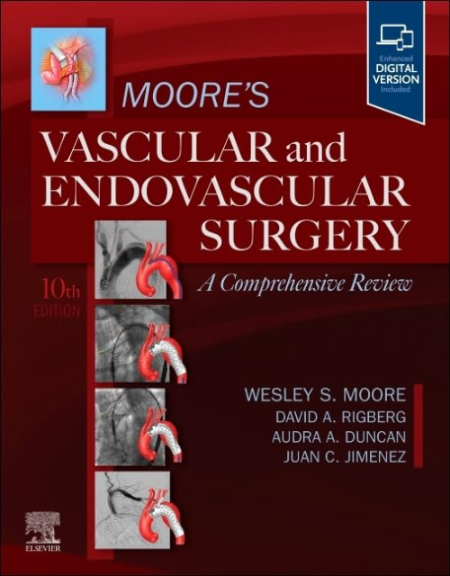 Moore's Vascular and Endovascular Surgery