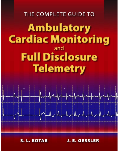 The Complete Guide To Ambulatory Cardiac Monitoring And Full Disclosure Telemetry