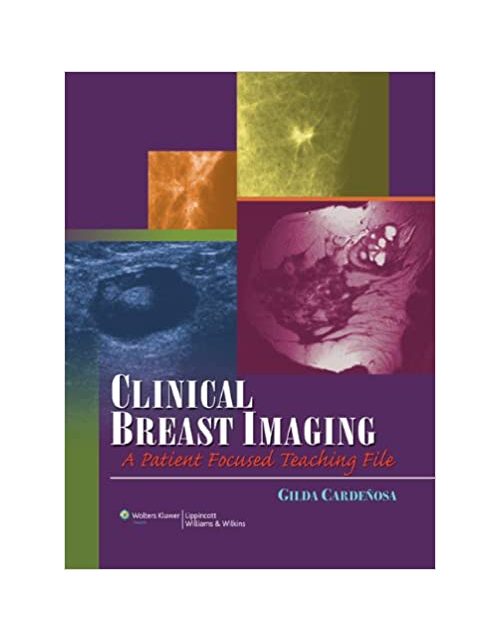 Clinical Breast Imaging: A Patient Focused Teaching File 1St Edición