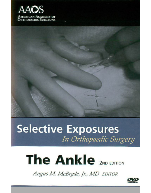 Selective Exposures in Orthopaedic Surgery : The Ankle