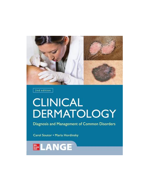 Clinical Dermatology: Diagnosis And Management Of Common Disorders