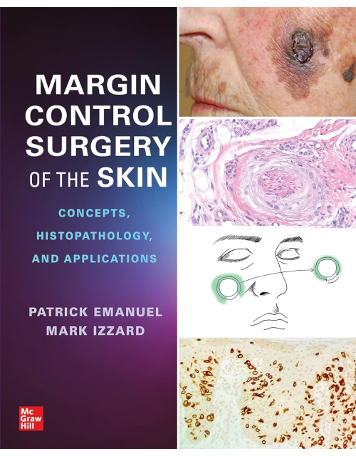 Margin Control Surgery of the Skin