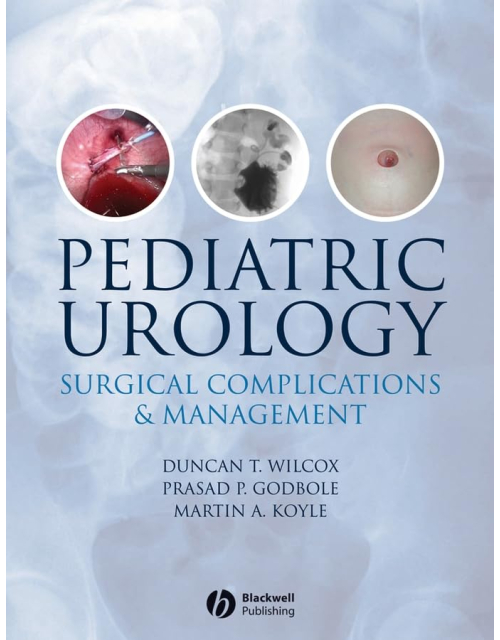 Pediatric Urology : Surgical Complications And Management