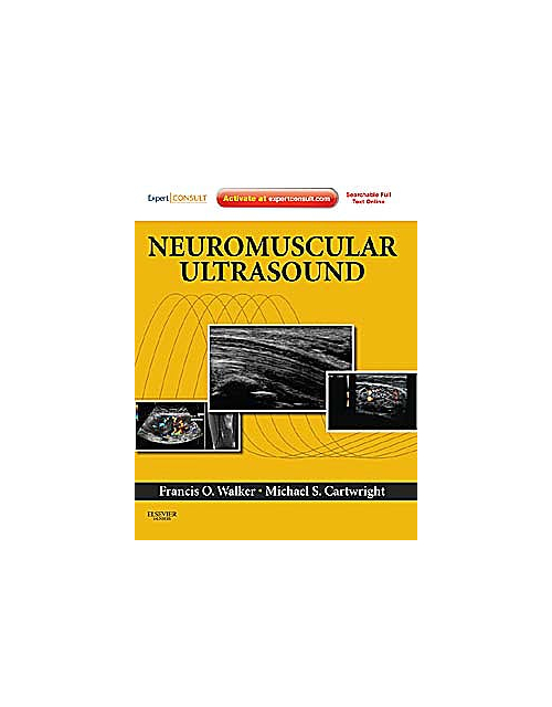 Neuromuscular Ultrasound