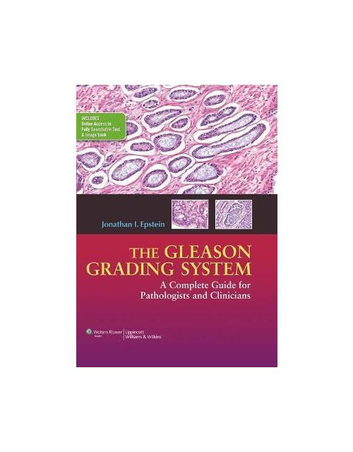 The Gleason Grading System