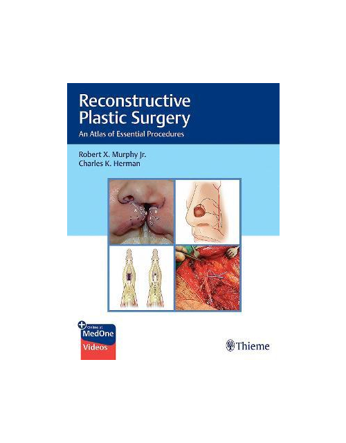 Reconstructive Plastic Surgery: An Atlas Of Essential Procedures 1St Edición, Edición Kindle