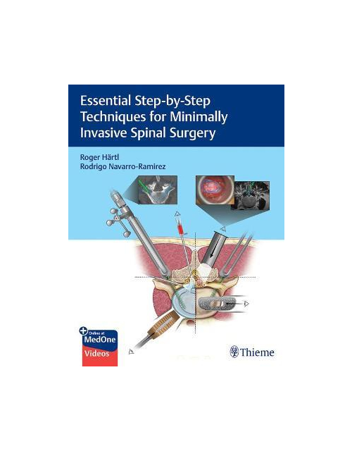 Essential Step-By-Step Techniques For Minimally Invasive Spinal Surgery 1St Edición
