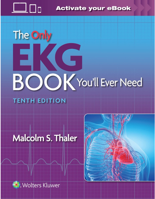 The Only Ekg Book You’Ll Ever Need