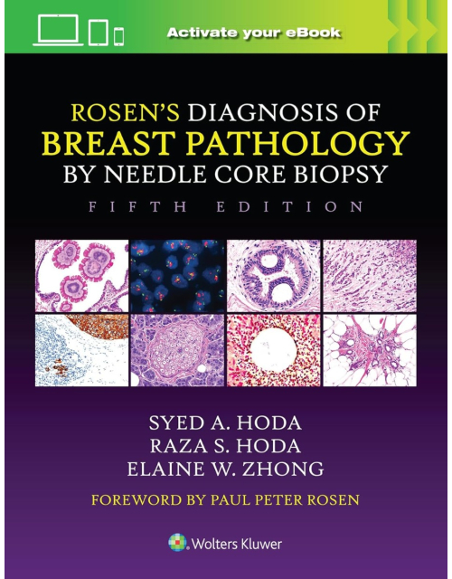ROSEN's Diagnosis of Breast Pathology by Needle Core Biopsy