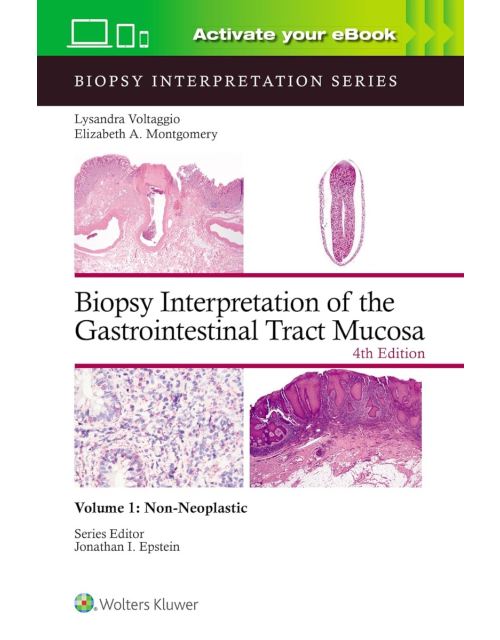 Biopsy Interpretation of the Gastrointestinal Tract Mucosa Volume 1