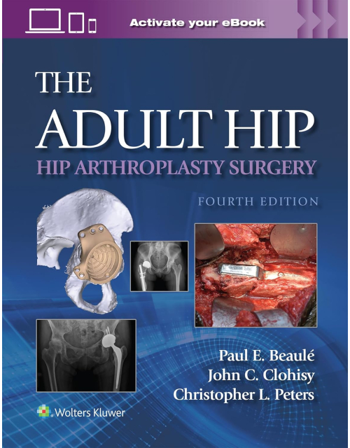 The Adult Hip. Hip Arthroplasty Surgery