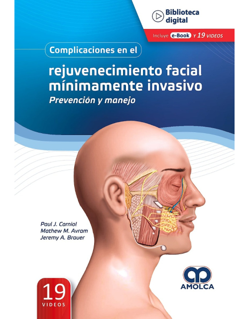 Complicaciones en el Rejuvenecimiento Facial Mínimamente Invasivo