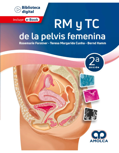RM y TC de la Pelvis Femenina