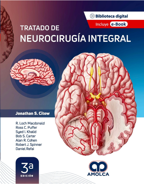 Tratado de Neurocirugía Integral