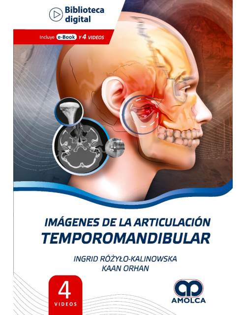 Imágenes de la Articulación Temporomandibular