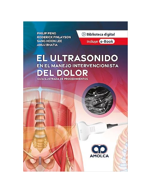 El Ultrasonido en el Manejo Intervencionista del Dolor