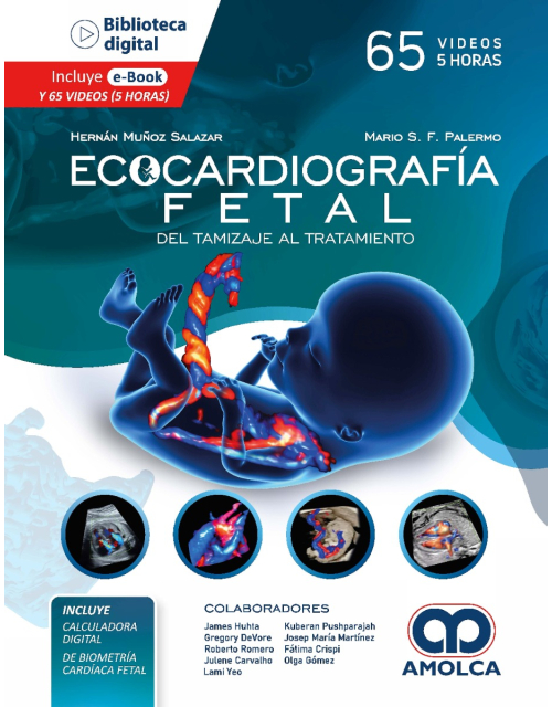 Ecocardiografía Fetal