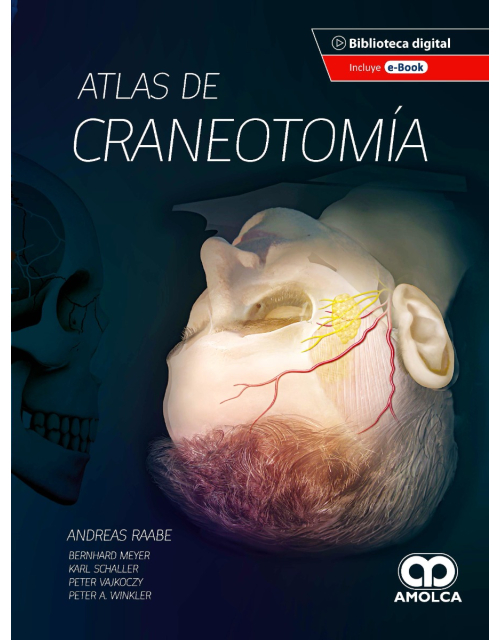 Atlas de Craneotomía