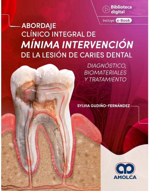 Abordaje Clínico Integral de Mínima Intervención de la Lesión de Caries Dental