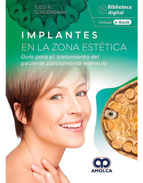 Implantes en la zona estética