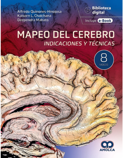 Mapeo del Cerebro. Indicaciones y Técnicas
